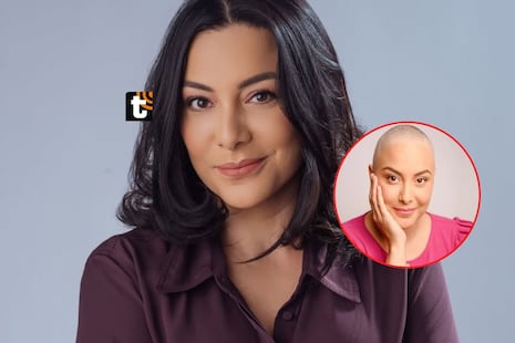 Natalia Salas explota contra las marcas que fingen cicatrices: “Me parece una burla y una falta de respet...