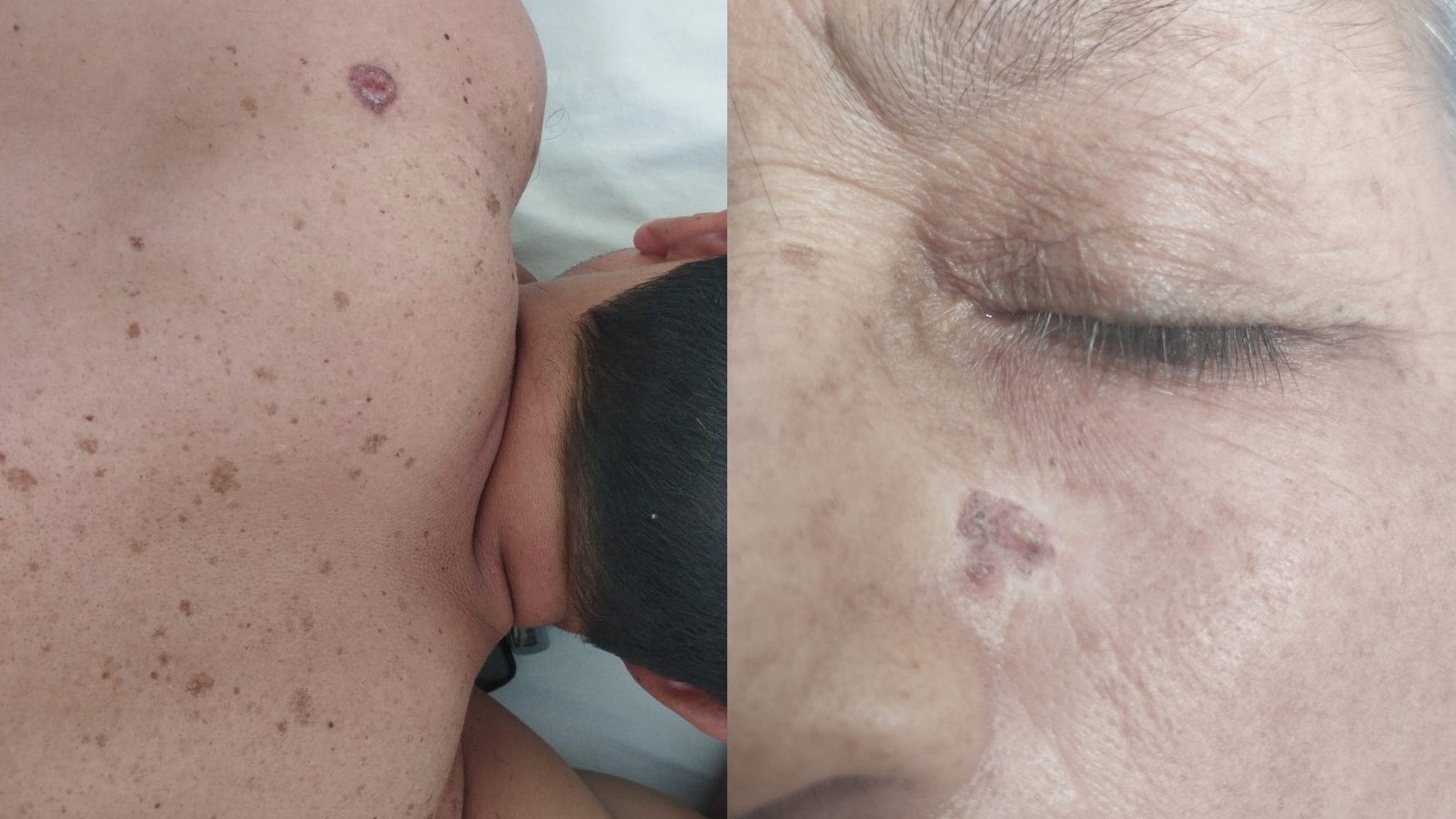 Cuidado de la piel y uso de protector solar.