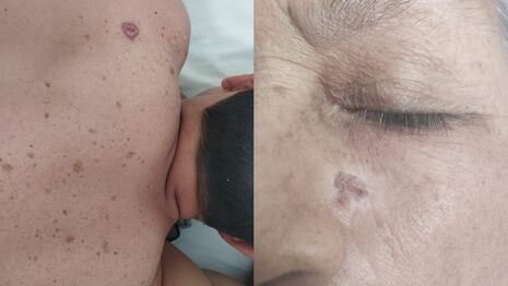 Cuidado de la piel: ¿Por qué se debe usar también protector solar dentro de la casa?