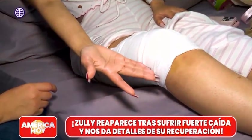 Tiktoker Zully terminó con 40 puntos tras fuerte accidente.