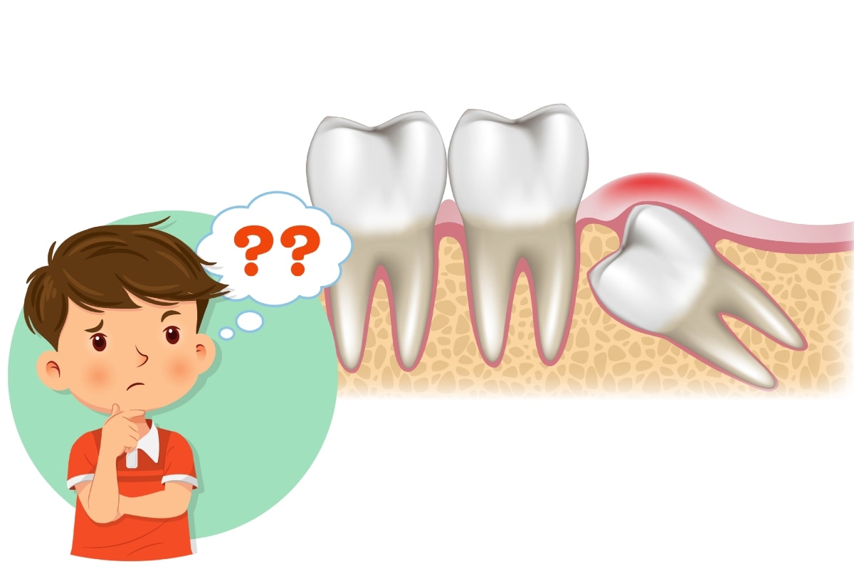 ¿Por qué las muelas del juicio se llaman así? Foto: Composición Istock.