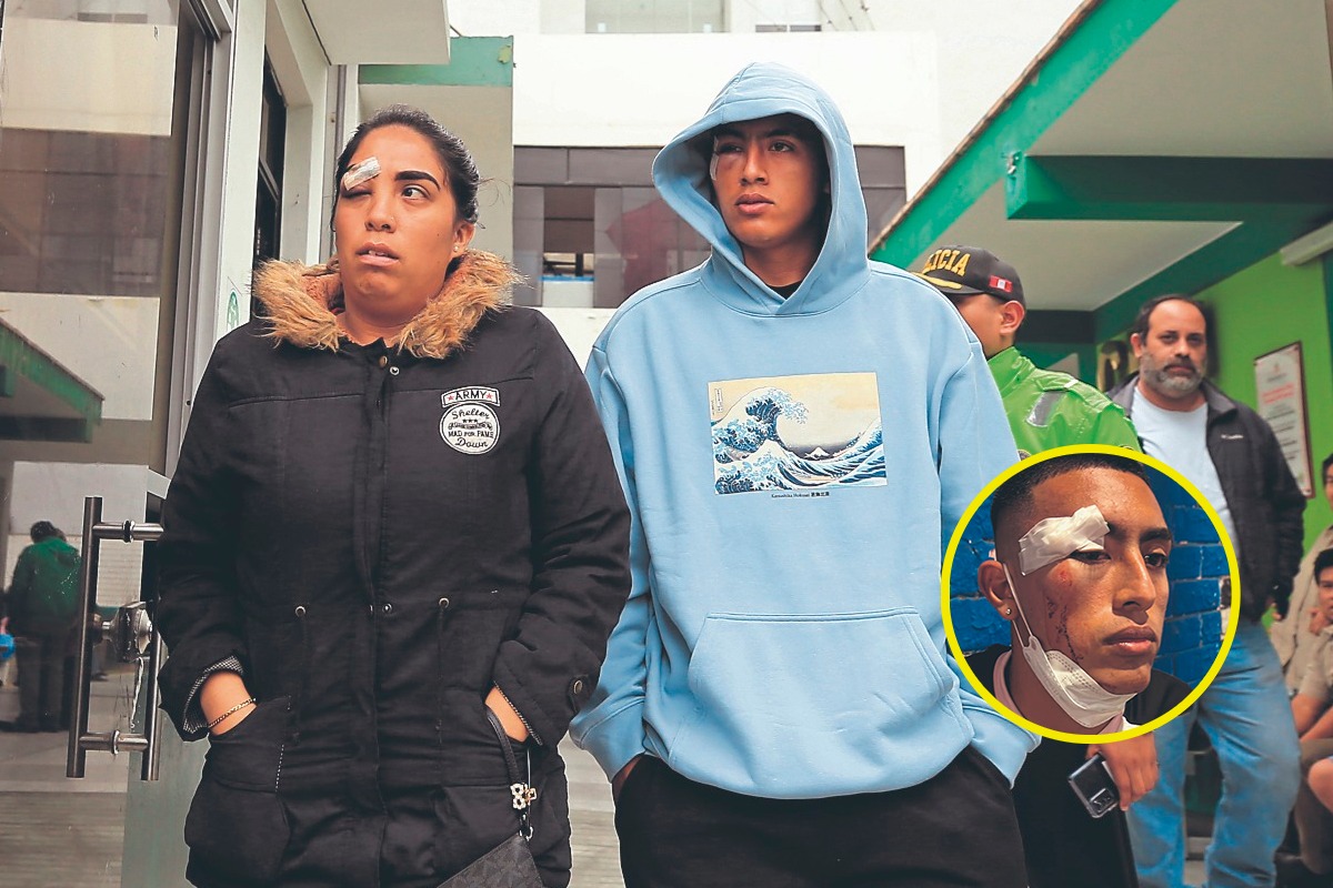 Jugador del Sport Boys fue agredido.