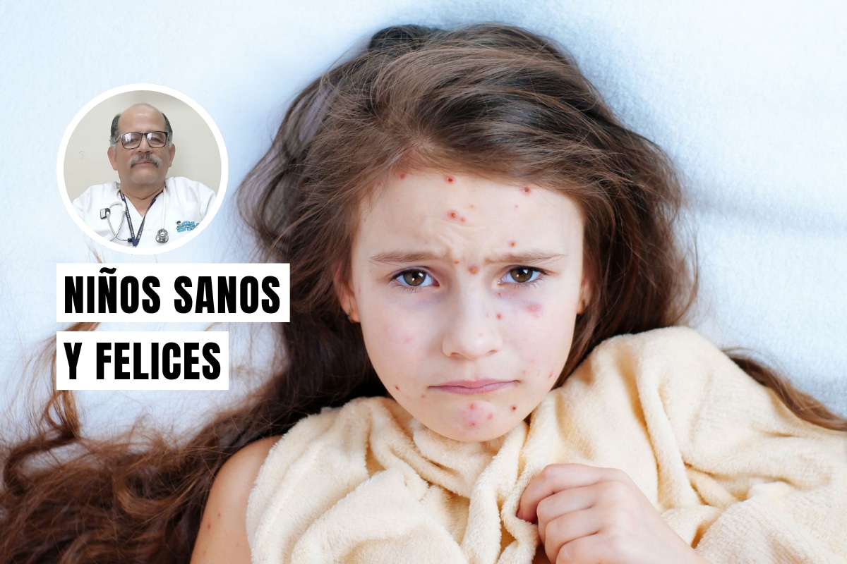 El pediatra comparte información clave para que los padres puedan reconocer las señales de alerta de las enfermedades eruptivas en los niños. Foto: Istock