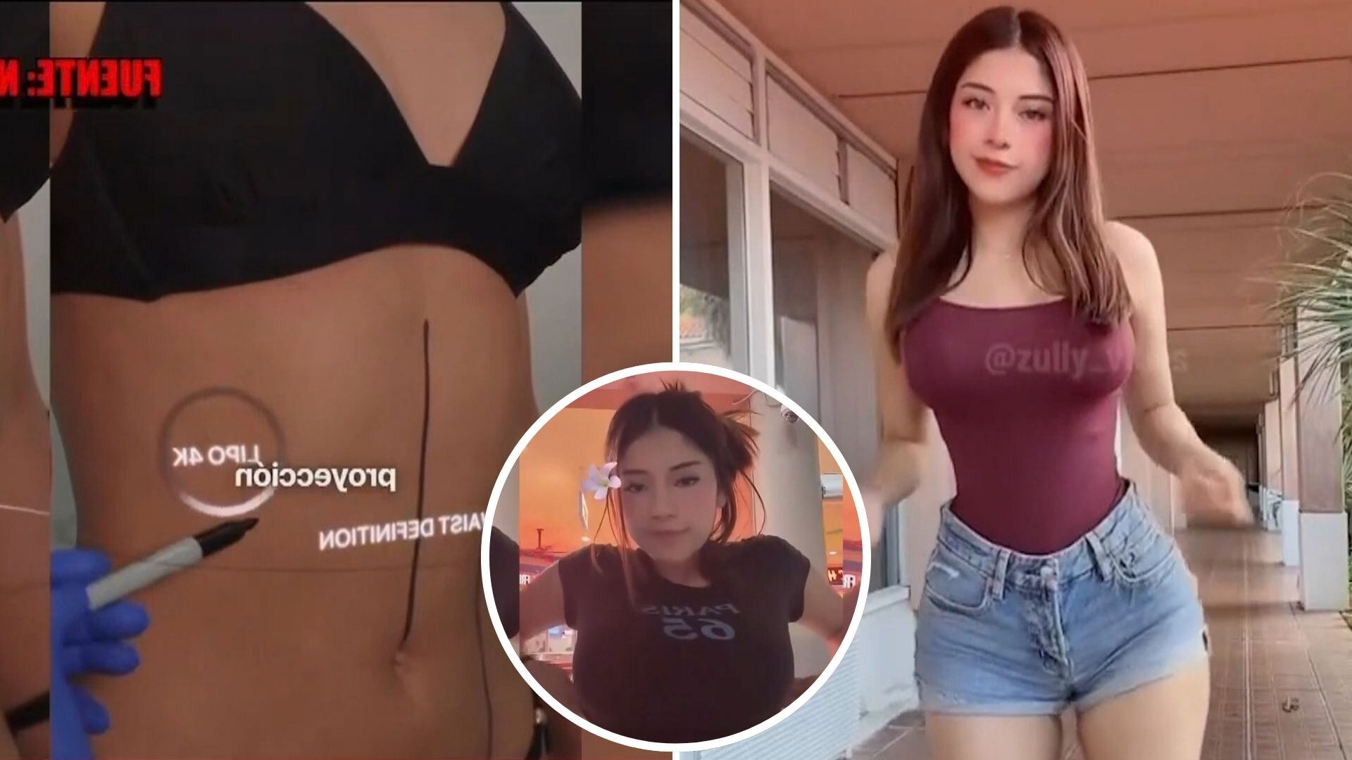 Zully sorprende al hablar del costo de sus cirugías