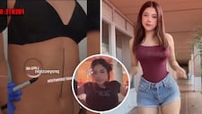 Zully sorprende al hablar del costo de sus cirugías