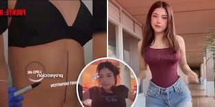 Zully sorprende al hablar del costo de sus cirugías