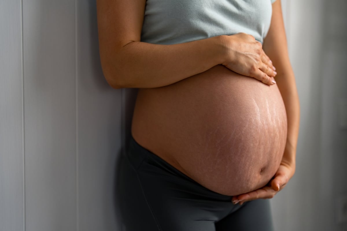 Hidratación, alimentación y constancia son claves para reducir el riesgo de estrías en esta etapa. Foto: Istock.