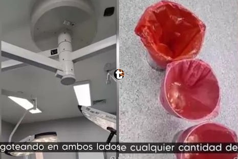 ¡Operación bajo la lluvia! Quirófano de hospital de San Juan de Lurigancho se inunda en plena cirugía