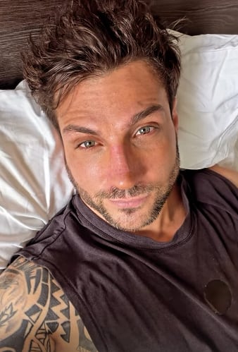 Nicola Porcella y su nueva nariz