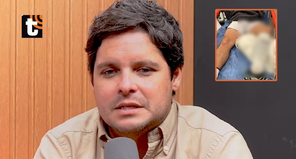 Gian Piero Díaz muestra vết thương khủng khiếp en su pierna: “Toca cirugía en estos días y una larga recuperación” | video | farándula | ĐẶC BIỆT | TROME.COM