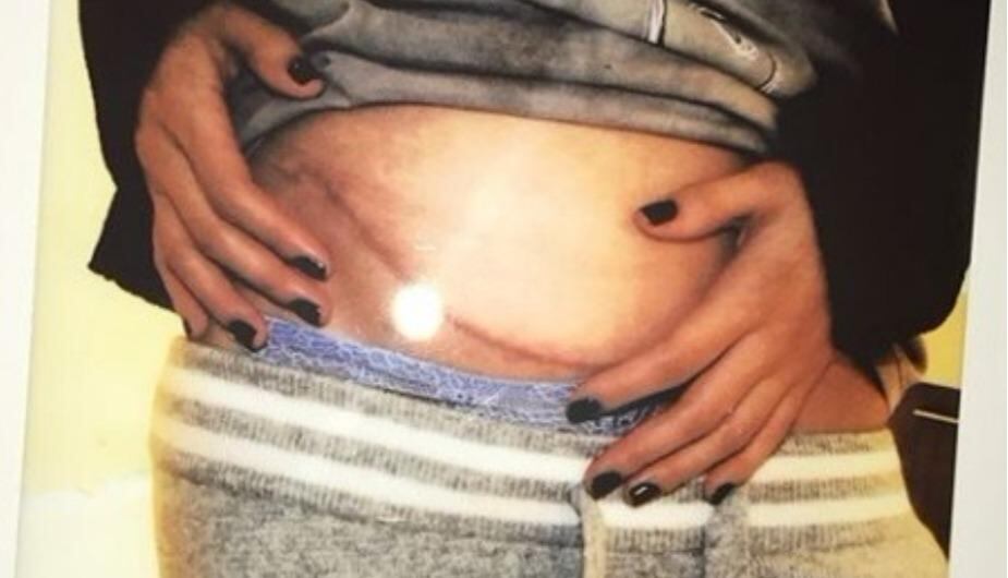 Una fotografía que compartió Selena Gomez tras su trasplante de riñon (Foto: Selena Gomez / Instagram)