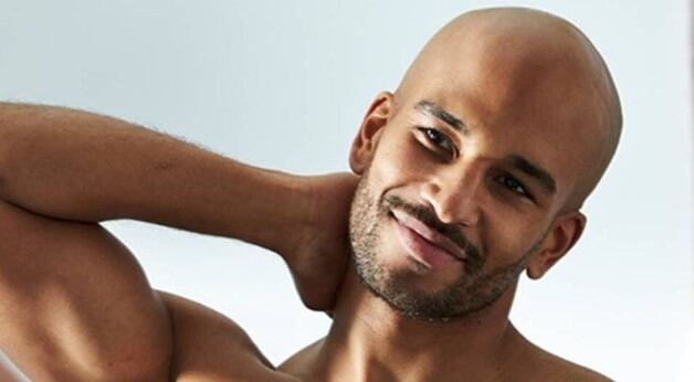 Normalmente, la ausencia de cabello está asociado a una falta de belleza (Foto: NIVEA)