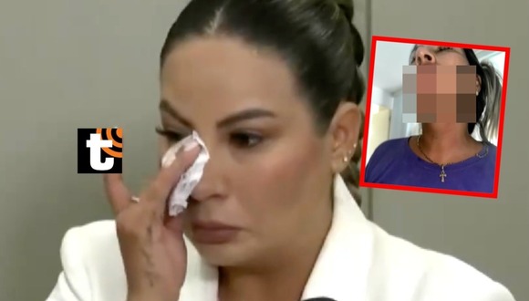 Pamela López muestra evidencia de ser golpeada por Cueva