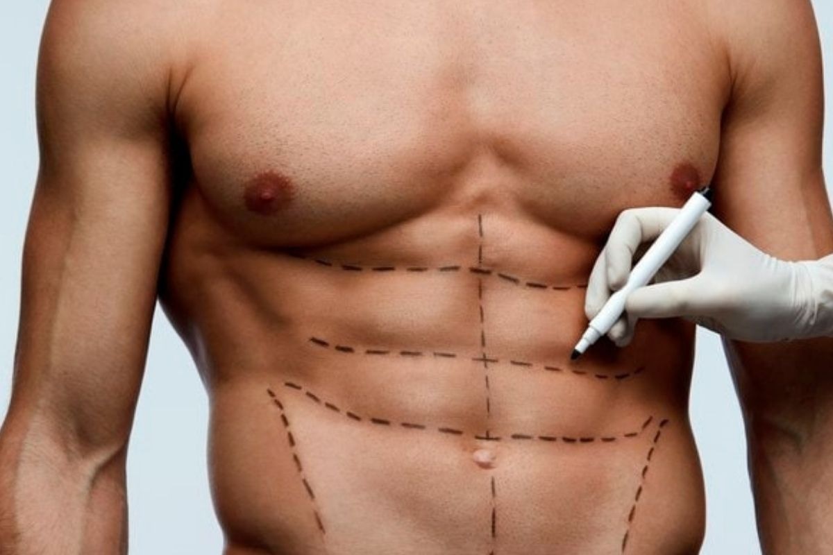 El especialista dice que es esencial que los pacientes sigan las recomendaciones médicas postoperatorias y mantengan un estilo de vida activo para mantener los resultados a largo plazo.