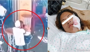 ¡Horror en Nasca! Sujeto desfigura la cara de su expareja con una hoja de afeitar y podría quedar libre