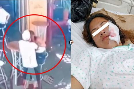 ¡Horror en Nasca! Sujeto desfigura la cara de su expareja con una hoja de afeitar y podría quedar libre