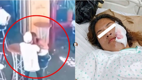 TROME | Sujeto le corta la cara a su expareja frente a una comisaría en Nasca. Video: ATV