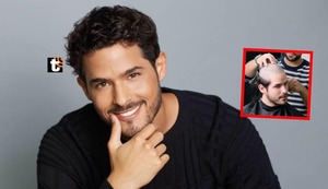 Andrés Vílchez se RAPA la cabeza para someterse a delicado tratamiento en Turquía: “Ya no hay vuelta atrás”