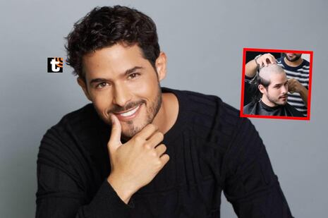 Andrés Vílchez se RAPA la cabeza para someterse a delicado tratamiento en Turquía: “Ya no hay vuelta atrá...