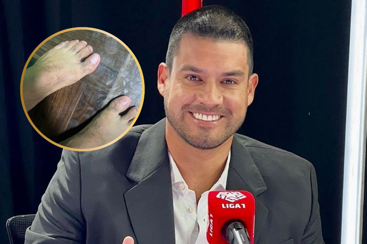 Erick Delgado muestra foto de sus pies