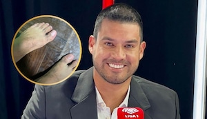 Erick Delgado responde a El Bombardero y muestra foto de sus pies: “¿Dónde están los champiñones?”