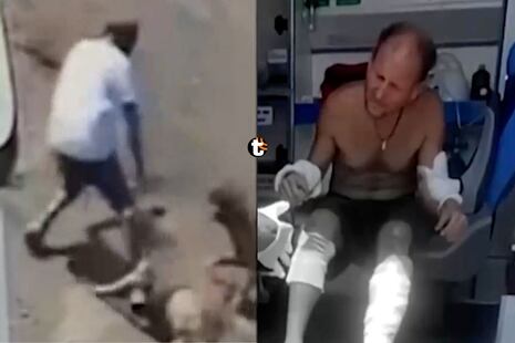 ¡Terror en Pachacámac! Dos perros atacan salvajemente a hombre cuando regresaba de hacer ejercicios