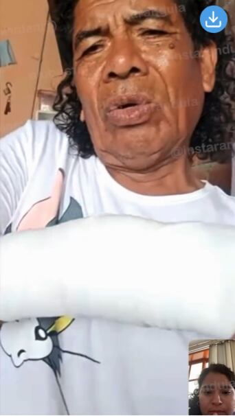 Cachay muestra su brazo derecho lesionado y afirma que tiene rota la muñeca tras brutal agresión.