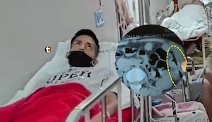 ¡Drama en el Loayza! Familiares denuncian que olvidaron material quirúrgico dentro de joven operado