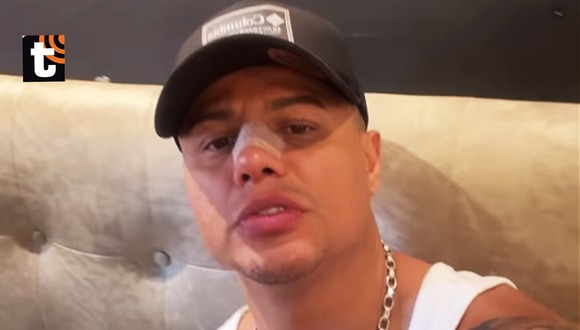 TROME - Jonathan Maicelo le responde a quienes critican su rinoplastia