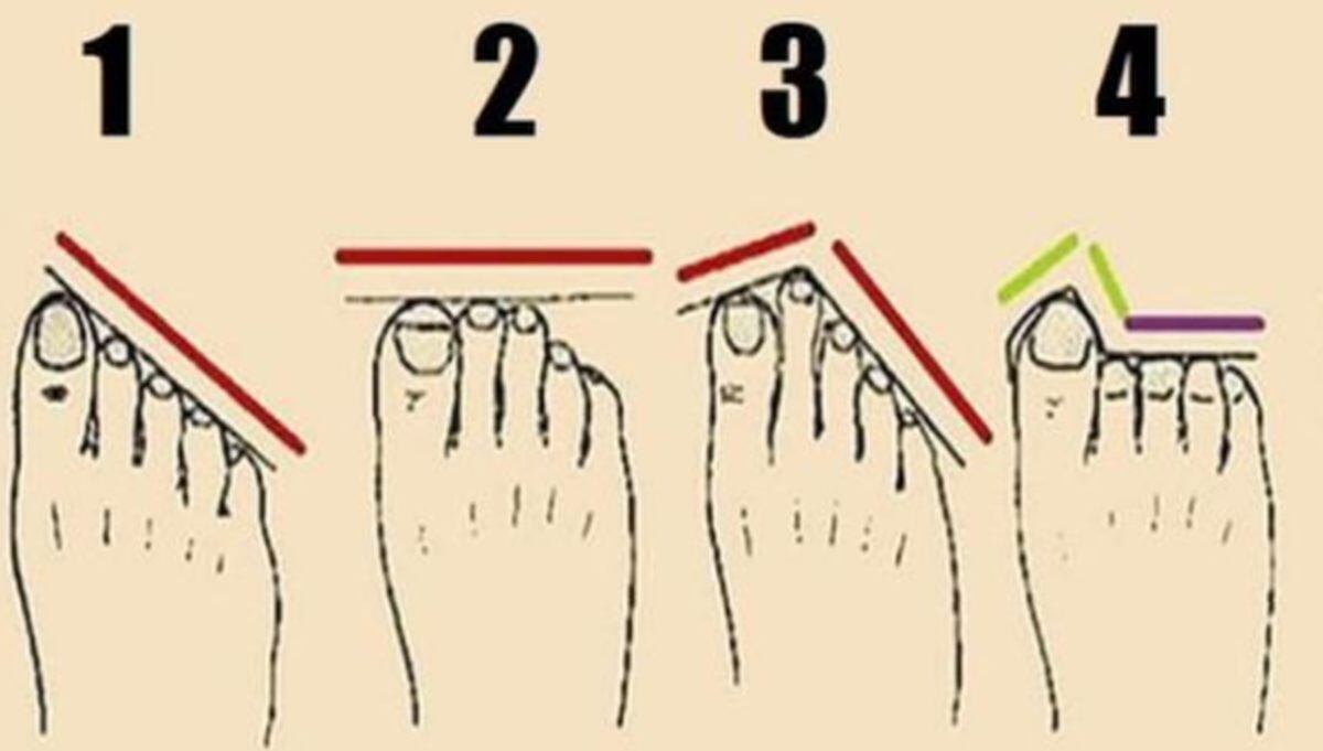 No todos los pies son iguales, por eso tendrás que elegir la forma que se asemeje más a los tuyos. Escoge entre el de los dedos en diagonal, el de los dedos al mismo nivel, el del dedo medio más grande que el resto o el del dedo pulgar más grande que los demás. Solo así estarás cerca de la respuesta. (Foto: mdzol)