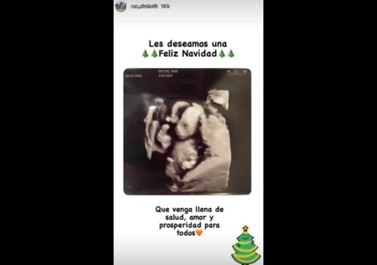 Edison Flores y Ana Siucho muestran la primera ecografía de su bebé