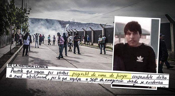 Joven recibió un balazo por la espalda y estuvo 6 días en UCI.