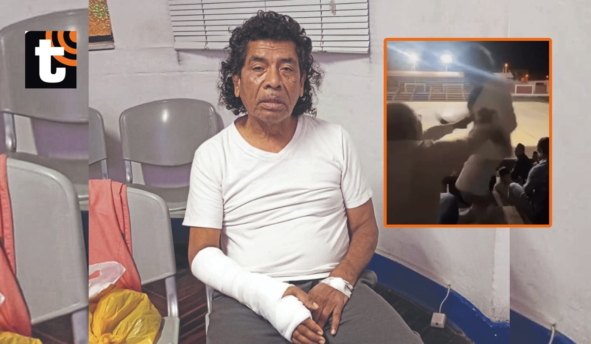Cachay comentó que su agresor se niega a cubrir los gastos de la cirugía y se declaró inocente de las acusaciones.