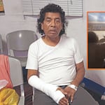 Cachay vendió carpa de circo para pagar cirugía de muñeca y acusa a agresor de evadir responsabilidad: “En el juicio se declaró inocente”