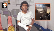 Cachay vendió carpa de circo para pagar cirugía de muñeca y acusa a agresor de evadir responsabilidad: “En el juicio se declaró inocente”