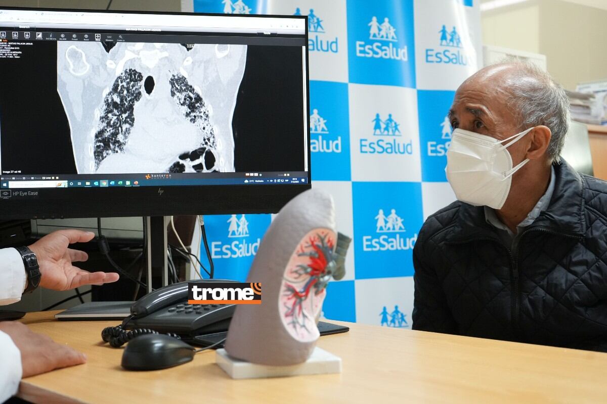 Gracias a donante, médicos especialistas y equipo adecuado se realizó exitoso trasplante de ambos pulmones en adulto mayor. (EsSalud)