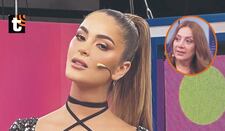 Laura Spoya perdió un diente durante accidente, según Pati Lorena: “Está mejor, pero chimuela”