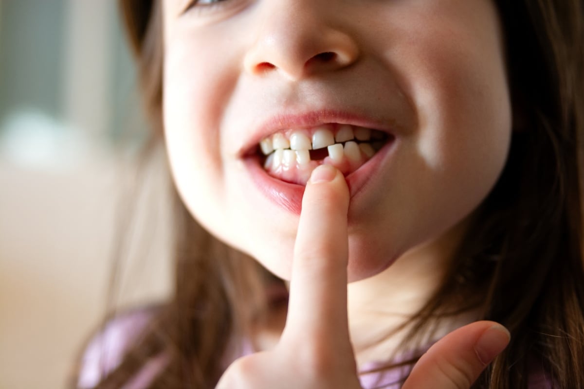 Aprende cómo cuidar la salud bucal de tu hijo durante la caída de sus dientes de leche. Foto: Istock.