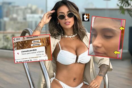 Shirley Arica denunciada por agresión física y exponen pruebas: “¡Te voy a matar!”