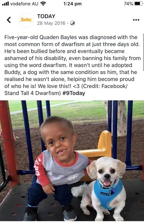 En el programa Today de NBC se emitió un reportaje de Quaden en el que se indica que tenía 5 años, fue emitido 2016. (Redes sociales)