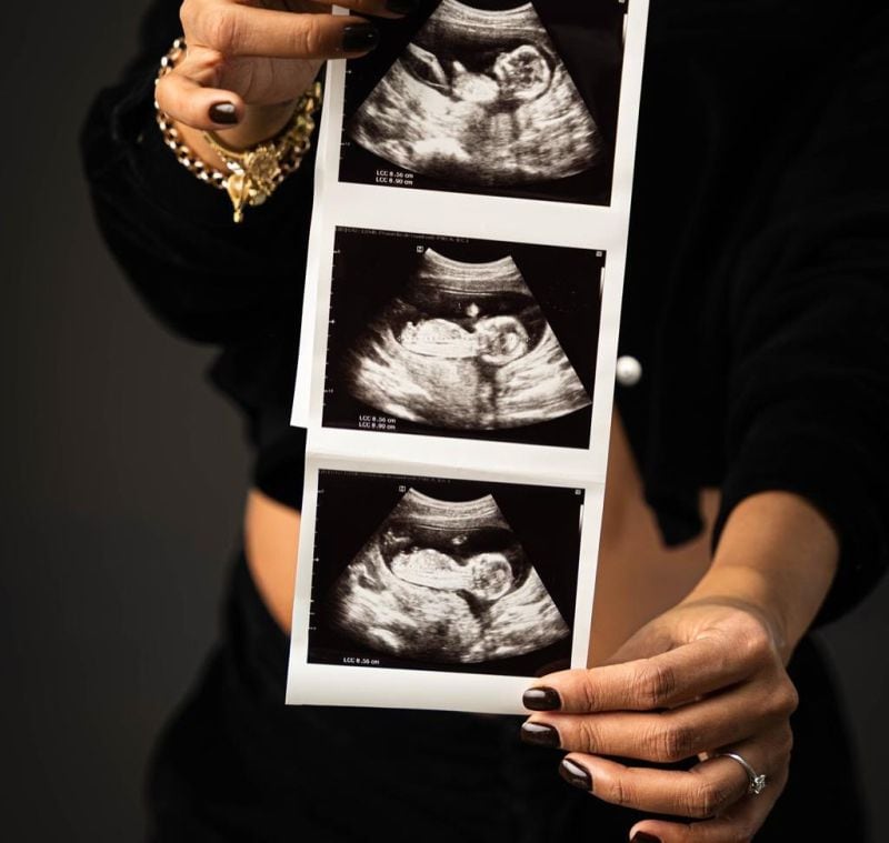 Ricardo Mendoza y su novia comparten ecografía de su bebé tras confirmar embarazo. (Foto: Instagram)