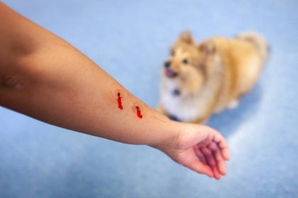 El pediatra Chacón explica qué debes hacer si un perro muerde a tu hijo. Foto: Istock.