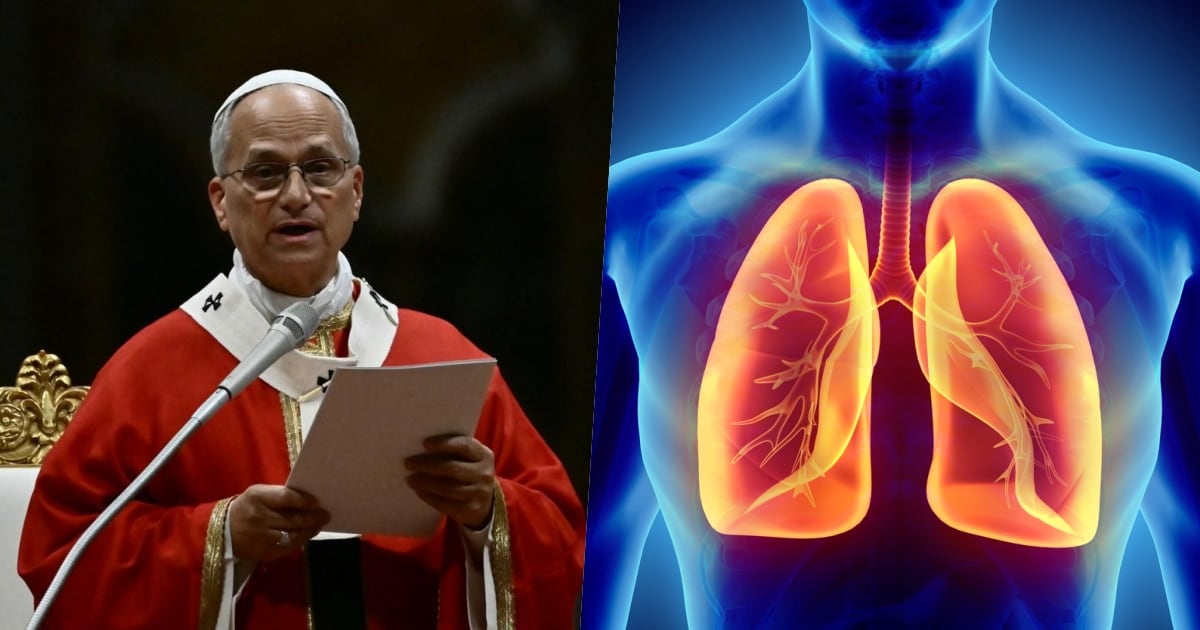 Un nódulo pulmonar es una pequeña zona anormal que mide menos de 3 centímetros (1 pulgada) y que a veces aparece en una tomografía computarizada del tórax o el abdomen, según la Sociedad Estadounidense del Cáncer. (Fotos: Agencias/ iStock)