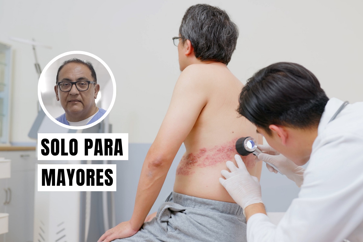 El geriatra Carlos Sandoval brinda información clave sobre el herpes zóster en el adulto mayor, una enfermedad que puede dejar secuelas dolorosas incluso después de desaparecer las lesiones. Foto: Istock.