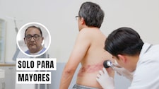 Herpes zóster en el adulto mayor: lo que debe saber sobre esta dolorosa enfermedad