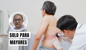Herpes zóster en el adulto mayor: lo que debe saber sobre esta dolorosa enfermedad