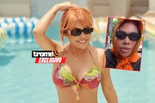 Magaly se pronuncia tras delicada operación: “Recuperándome, pero me siento muy débil”