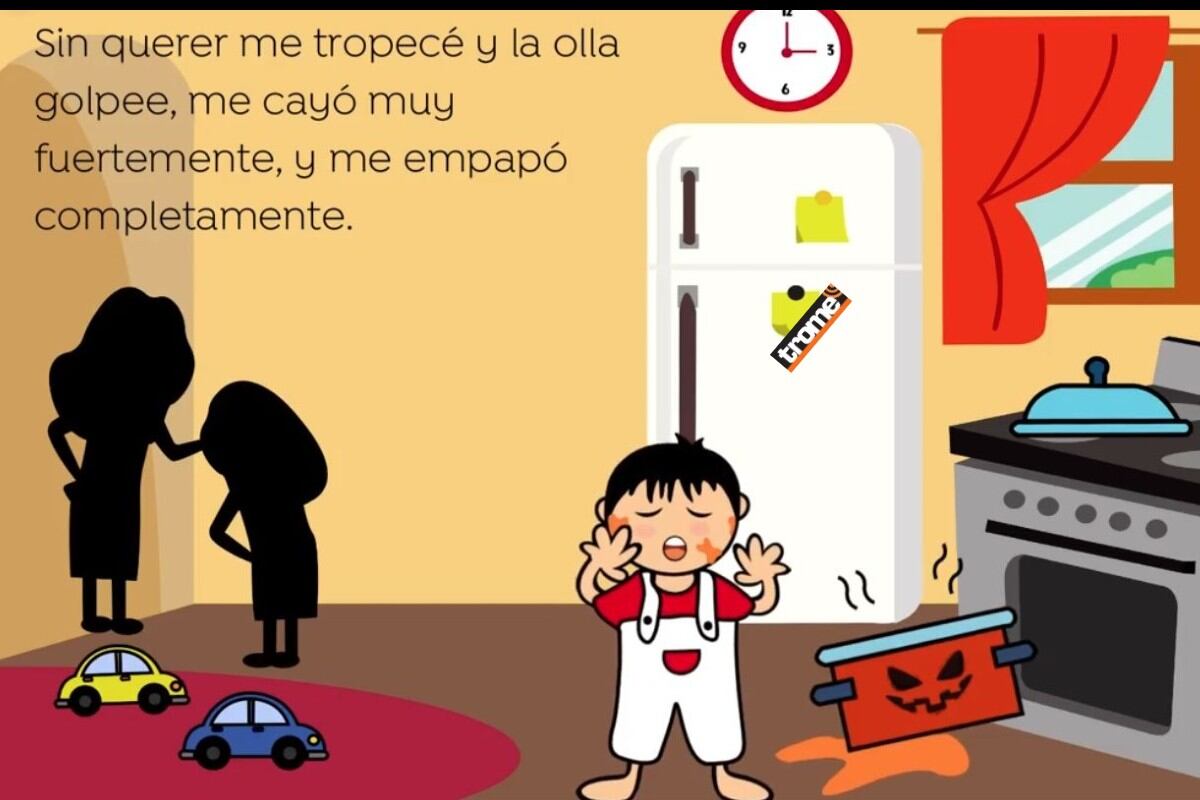 Empresas y ciudadanos, a través del reciclaje, pueden ayudar a Aniquem en el tratamiento de niños que han sufrido quemaduras. (Aniquem / Compos. Trome).