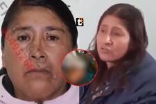 ¡Todo por un terreno! Mató a su cuñada, la descuartizó, le sacó los órganos y dejó sus restos en bolsas