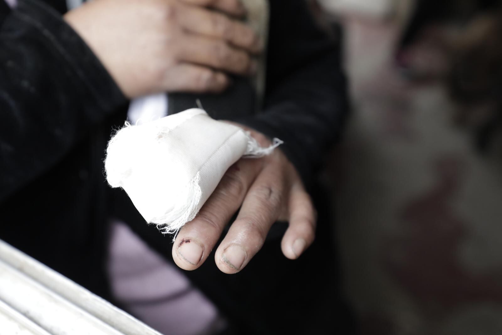 Mamá de la víctima se salvó de morir de milagro. Dos balas le rozaron. Una de ellas en uno de sus dedos. | Foto: Jessica Vicente